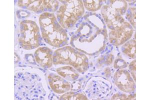 Immunohistochemistry (IHC) image for anti-Induced Myeloid Leukemia Cell Differentiation Protein Mcl-1 (MCL1) antibody (ABIN4904325)