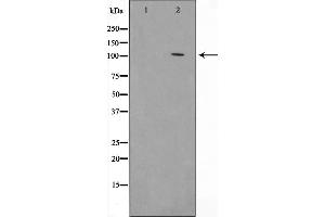 Western blot analysis on HeLa cell lysate using HSP105 Antibody,The lane on the left is treated with the antigen-specific peptide. (HSPH1 抗体  (C-Term))