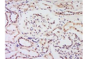 Formalin-fixed and paraffin embedded human kidney labeled with Anti-Bcl-2 Polyclonal Antibody, Unconjugated  at 1:200 followed by conjugation to the secondary antibody and DAB staining. (Bcl-2 抗体  (AA 51-150))