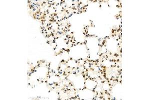 Immunohistochemistry of paraffin embedded mouse lung using HIF-3α (ABIN7074273) at dilution of 1:1600 (400x lens) (HIF3A 抗体)