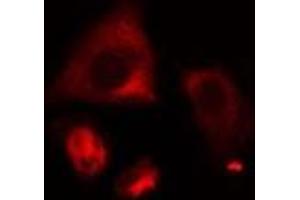 Immunofluorescence (fixed cells) (IF/ICC) image for anti-Ceroid-Lipofuscinosis, Neuronal 6, Late Infantile, Variant (CLN6) (Internal Region) antibody (ABIN6259070)