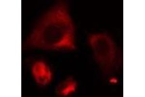 ABIN6274999 staining HeLa cells by IF/ICC. (CLN6 抗体  (Internal Region))