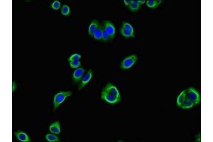 Immunofluorescent analysis of HepG2 cells using ABIN7162603 at dilution of 1:100 and Alexa Fluor 488-congugated AffiniPure Goat Anti-Rabbit IgG(H+L) (PANK2 抗体  (AA 437-490))