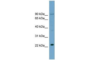 WB Suggested Anti-C15orf15 Antibody Titration: 0. (RSL24D1 抗体  (Middle Region))
