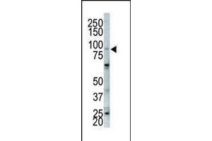 Western blot analysis of anti-FGFR2 Pab in NCI-H460 cell lysate