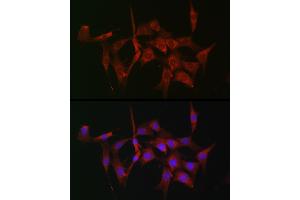 Immunofluorescence analysis of NIH-3T3 cells using [KO Validated] Fascin/Fascin/FSCN1 Rabbit pAb (ABIN3023681, ABIN3023682, ABIN3023683, ABIN1679910 and ABIN1679911) at dilution of 1:100 (40x lens). (Fascin 抗体  (AA 394-493))