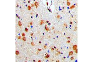 Immunohistochemical analysis of Beta-arrestin-1 staining in human brain formalin fixed paraffin embedded tissue section. (beta Arrestin 1 抗体  (C-Term))