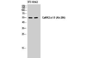 Western Blotting (WB) image for anti-CaMKIIalpha/delta (Lys542) antibody (ABIN3183638) (CaMKIIalpha/delta 抗体  (Lys542))