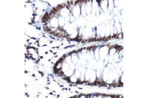 Immunohistochemistry of paraffin-embedded human colon using SF3 Rabbit pAb (ABIN1682671, ABIN3018959, ABIN3018960 and ABIN6220644) at dilution of 1:100 (40x lens).
