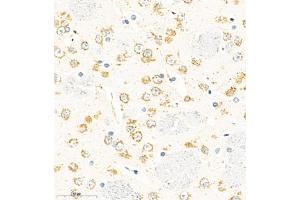 Immunohistochemistry of paraffin embedded rat brain using TMEM176A (ABIN7075995) at dilution of 1:500 (400x lens) (TMEM176A 抗体)