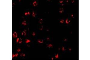 Immunofluorescence of PUMA in K562 cells with PUMA antibody at 10 ug/ml (PUMA 抗体  (N-Term))