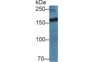 Detection of MYOM2 in Porcine Skeletal muscle lysate using Polyclonal Antibody to Myomesin 2 (MYOM2) (MYOM2 抗体  (AA 1130-1434))