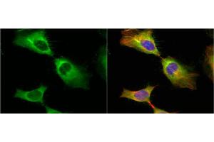 Immunofluorescence (IF) image for anti-Heat Shock 27kDa Protein 1 (HSPB1) (Center) antibody (ABIN2854951)