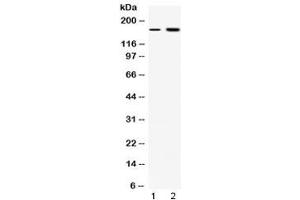 Western blot testing of 1) rat liver and 2) COLO320 lysate with CSB antibody at 0. (ERCC6 抗体  (AA 160-205))