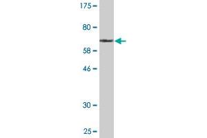 Western Blot detection against Immunogen (68. (HERPUD1 抗体  (AA 1-391))