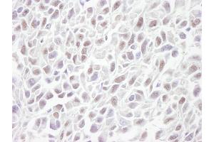 Immunohistochemistry (IHC) image for anti-Structural Maintenance of Chromosomes 3 (SMC3) (C-Term) antibody (ABIN7448804)