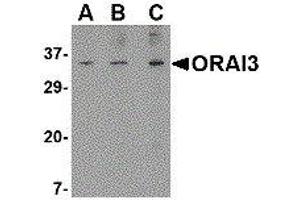 Western Blotting (WB) image for anti-ORAI Calcium Release-Activated Calcium Modulator 3 (ORAI3) (N-Term) antibody (ABIN2475965) (ORAI3 抗体  (N-Term))