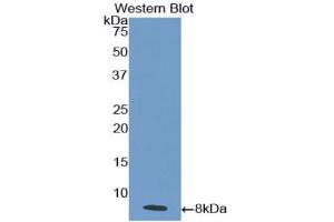 Western blot analysis of the recombinant protein. (IL18R1 抗体  (AA 375-428))