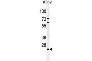C15orf41 Antibody (Center) western blot analysis in K562 cell line lysates (35µg/lane). (BC052040 抗体  (Middle Region))