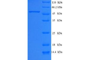 SDS-PAGE (SDS) image for Aminoadipate-Semialdehyde Dehydrogenase-phosphopantetheinyl Transferase (AASDHPPT) (AA 1-309), (full length) protein (His-SUMO Tag) (ABIN5711789) (AASDHPPT Protein (AA 1-309, full length) (His-SUMO Tag))