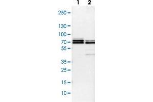 Western Blot (Cell lysate) analysis with TRAF6 polyclonal antibody  Lane 1: NIH-3T3 cell lysate (Mouse embryonic fibroblast cells) Lane 2: NBT-II cell lysate (Rat Wistar bladder tumour cells) (TRAF6 抗体)