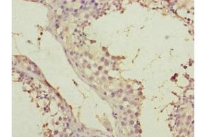 Immunohistochemistry of paraffin-embedded human testis tissue using ABIN7170586 at dilution of 1:100 (SPICE1 抗体  (AA 1-220))