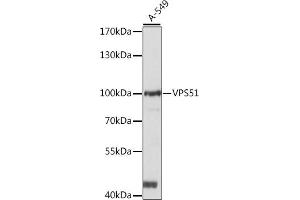 Western blot analysis of extracts of A-549 cells, using VPS51 antibody (ABIN7271280) at 1:1000 dilution. (VPS51 抗体  (AA 1-260))