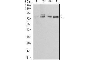 Western Blotting (WB) image for anti-Ezrin (EZR) (AA 292-464) antibody (ABIN5886560) (Ezrin 抗体  (AA 292-464))