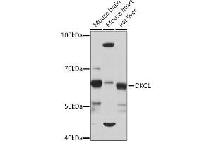 Western blot analysis of extracts of various cell lines, using DKC1 Rabbit mAb (ABIN7266869) at 1:1000 dilution. (DKC1 抗体)