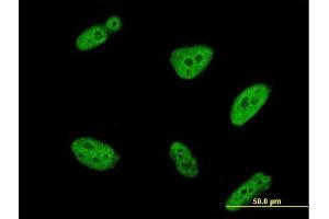 Immunofluorescence of monoclonal antibody to POLR3K on HeLa cell.