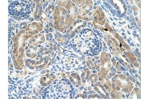 CRELD1 antibody was used for immunohistochemistry at a concentration of 4-8 ug/ml.