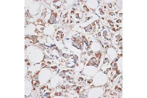 Immunohistochemistry (IHC) image for anti-Kinesin Family Member 14 (KIF14) (AA 1399-1648) antibody (ABIN6142854)