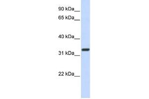 WB Suggested Anti-Nkx2-5 Antibody Titration: 0. (NK2 Homeobox 5 抗体  (N-Term))