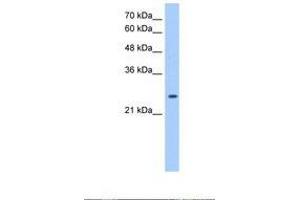 Image no. 1 for anti-Peroxiredoxin 6 (PRDX6) (AA 131-180) antibody (ABIN321415) (Peroxiredoxin 6 抗体  (AA 131-180))