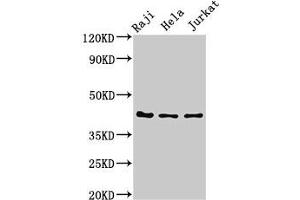 Western Blot Positive WB detected in: Raji whole cell lysate, Hela whole cell lysate, Jurkat whole cell lysate All lanes: Pregnancy-associated glycoprotein 1 antibody at 3 μg/mL Secondary Goat polyclonal to rabbit IgG at 1/50000 dilution Predicted band size: 43 kDa Observed band size: 43 kDa (PAG1 抗体  (AA 54-380))