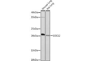 Western blot analysis of extracts of various cell lines, using SOCS2 Rabbit mAb (ABIN7270641) at 1:1000 dilution. (SOCS2 抗体)