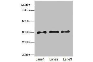 Western blot All lanes: PRPS1antibody at 6. (PRPS1 抗体  (AA 1-318))