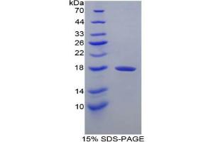 SDS-PAGE analysis of Dog Transthyretin Protein. (TTR 蛋白)