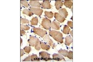 ARL17P1 Antibody (Center) (ABIN655544 and ABIN2845053) immunohistochemistry analysis in formalin fixed and paraffin embedded human skeletal muscle followed by peroxidase conjugation of the secondary antibody and DAB staining. (ARL17A 抗体  (AA 102-130))