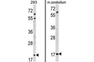 (LEFT) Western blot analysis of MOBP Antibody (N-term) in 293 cell line lysates (35ug/lane). (MOBP 抗体  (N-Term))