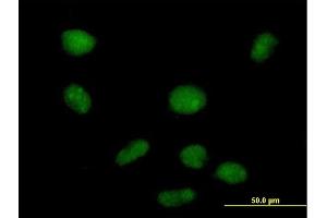 Immunofluorescence of purified MaxPab antibody to PHF19 on HeLa cell. (PHF19 抗体  (AA 1-207))