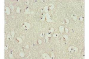 Immunohistochemistry of paraffin-embedded human brain tissue using ABIN7167620 at dilution of 1:100 (RGS7 抗体  (AA 1-300))
