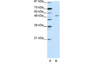 WB Suggested Anti-ZNF498 Antibody Titration:  5. (Zinc Finger and SCAN Domain Containing 25 (ZSCAN25) (C-Term) 抗体)