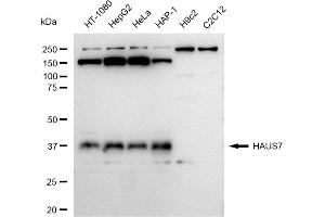 Western blotting analysis using HAUS7 antibody (ABIN7798838). (Recombinant HAUS7 抗体)