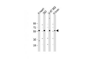 All lanes : Anti-ENTPD2 Antibody (N-term) at 1:2000 dilution Lane 1: H. (ENTPD2 抗体  (N-Term))