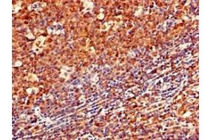 Immunohistochemistry of paraffin-embedded human tonsil tissue using ABIN7145141 at dilution of 1:100 (CD79a 抗体  (AA 70-142))