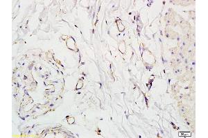 Immunohistochemistry (IHC) image for anti-Solute Carrier Family 5 (Iodide Transporter), Member 8 (SLC5A8) (AA 301-400) antibody (ABIN762521)