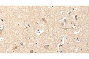Immunohistochemistry of paraffin-embedded Human brain tissue using RRAD Polyclonal Antibody at dilution 1:50 (RRAD 抗体)