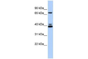 WB Suggested Anti-GATA6 Antibody Titration: 0. (GATA6 抗体  (Middle Region))