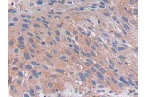 DAB staining on IHC-P; Samples: Human Lung Tissue (PCSK5 抗体  (AA 115-454))